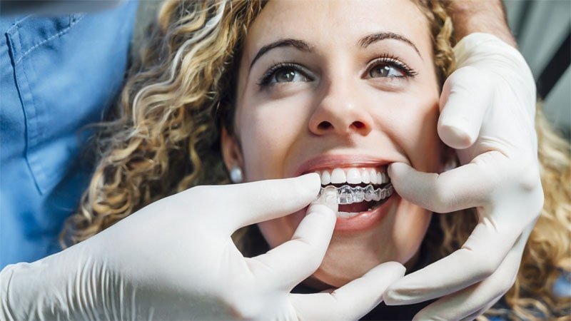 Get Straight Teeth With Invisalign, Free Consultation