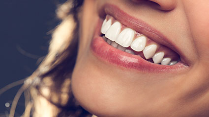 Get a beautiful smile with teeth veneers in just 2 visits